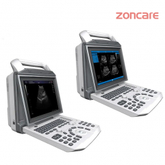 Zoncare i50 Full Digital Color Doppler Portable Ultrasonic Diagnostic System