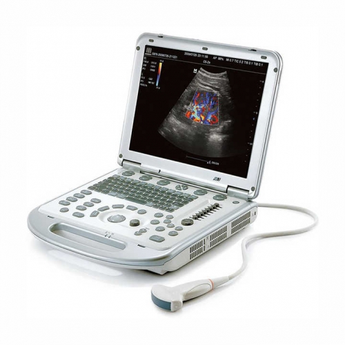 Mindray M7T Medical Color Doppler Digital Ultrasound Price Human Pregnancy Cardiovascular Laptop Ultrasound Scanner