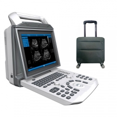 Zoncare i50 Medical Ultrasound Diagnostic Equipment Full Digital 4d Color Dopler Portable Ultrasonography Machine