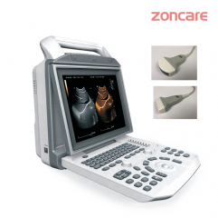 Zoncare i50 Laptop Medical Full Digital Color Doppler Portable Ultrasound System Diagnostic Scanner Machine 3d 4d For Hospital