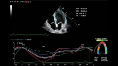 Mindray Consona N8T High Quality Ultrasound System Price Digital Ultrasound Diagnostic Instruments Ultrasound Scanner