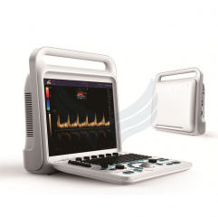 XianFeng E60 Best Seller 3d/4d/5d Digital Portable Color Doppler Ultrasound Scanner Echo Cardiac Imaging Machine