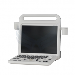 XianFeng E60 Portable Ultrasound System Medical Echocardiography 4d Color Doppler Ultrasound Machine