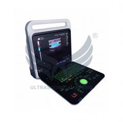 XianFeng E80 Portable Color Doppler Diagnostic Ultrasound System Digital 4d 5d Color Doppler Ultrasound Scanner