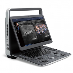 Sonoscape E2 Big Screen Portable 2d Color Doppler Msk Ob/gyn Ultrasound Scanner For Sale