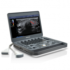 Sonoscape X3 Hand-carried Medical Fibroscan Machine Portable Color Doppler Diagnostic Ultrasound Scanner Price In Dubai