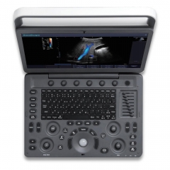 High Quality 15.6 Inch Sonoscape E2 High Resolution Color Doppler Ultrasound Machine