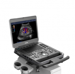 Sonoscape X3 Hand-carried Color Doppler Small Size,Smart Sight