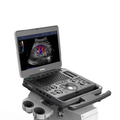 Sonoscape X3 Medical Multi-function 2d/3d Color Doppler Ultrasound Echography Machine Hand Carried Ultrasound Scanner