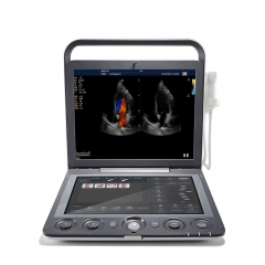 Sonoscape S9 Hospital Portable Color Doppler Ecograph Best Price 3d 4d Veterinary Portable Color Doppler Ultrasound