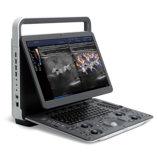 Sonoscape E2 Color Doppler B/w Ultrasound Equipment Portable Ultrasound Scanner