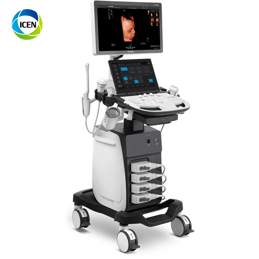 Sonography Instruments Sonoscape P11 Medical Ultrasound Instruments Pw Color Doppler Portable ...