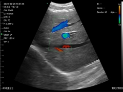 IN-5CPL Highest Cost-effective Double Probes Wireless Color Doppler Ultrasound Scanner Wireless Linear Ultrasound Probe