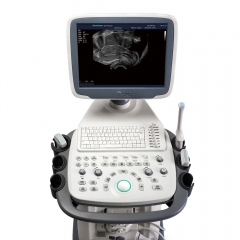 Sonoscape S11 Plus High Definition Double Screen Trolley Color Doppler Ultrasound Machine Medical 4d Ultrasound System