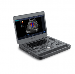 Sonoscape X3 Medical Multi-function 2d/3d Color Doppler Ultrasound Echography Machine Hand Carried Ultrasound Scanner