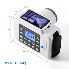 IN-D123 Wholesale Portable Dental X Ray Dental Rvg Hand Held Digital X-ray X Ray Instant Camera With Cassette