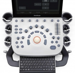 Sonoscape P9 Medical Trolley Type Color Doppler Ultrasound Equipment Ultrasound Machine Price