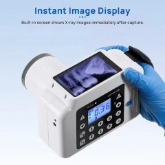 IN-D123 Wholesale Portable Dental X Ray Dental Rvg Hand Held Digital X-ray X Ray Instant Camera With Cassette