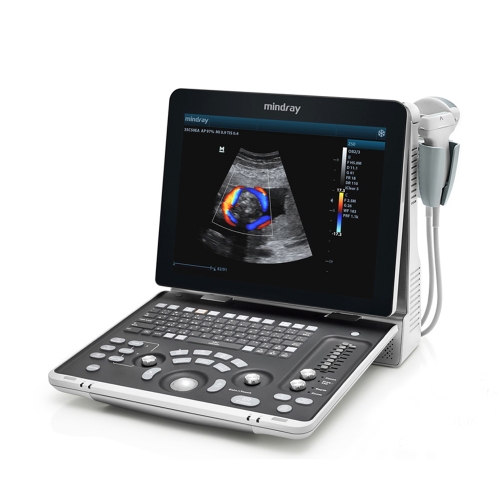 Mindray Z50BW Hospital Pregnancy Ultrasound Machine Mindray 3d/4d Color Doppler Ultrasound Scanner