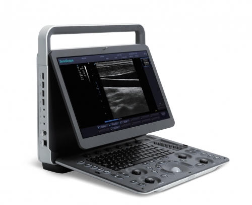 Sonoscape E1 Medical Ultrasound Instruments 4d Ultrasound Machine Ultrasound