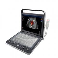 Sonoscape S9 High Quality Portable Ultrasound System Hospital Ultrasound Scanner Color Doppler