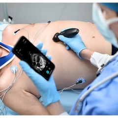 Mindray TE Air I3P Professional Portable Ultrasound Color Doppler Ultrasound Machine