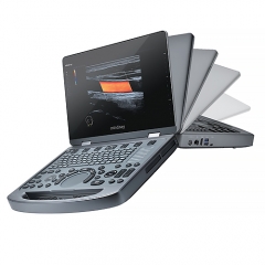 Mindray MX5 Spot Product Portable Ultrasound Machine Diagnostic Imaging System Portable Ultrasound Machine