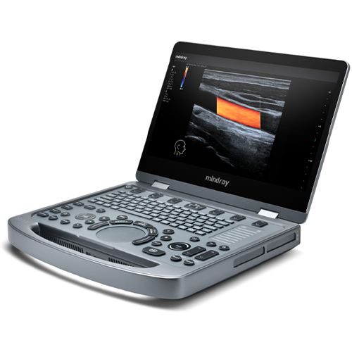 Mindray MX3 Medical Portable Automatic Color Doppler Ultrasound Scanner Diagnostic System