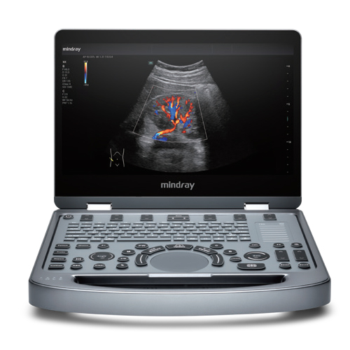 Mindray MX5 Spot Product Portable Ultrasound Machine Diagnostic Imaging System Portable Ultrasound Machine