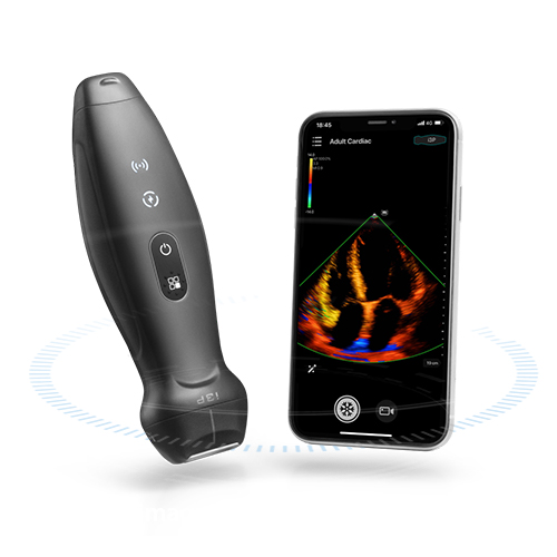 Mindray TE Air I3P Professional Portable Ultrasound Color Doppler Ultrasound Machine
