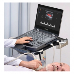 Mindray MX5 Spot Product Portable Ultrasound Machine Diagnostic Imaging System Portable Ultrasound Machine
