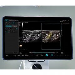 Mindray TEX20 Elite Edition Color Doppler Ultrasonido Ultrasound Scanner Machine Cheap Price