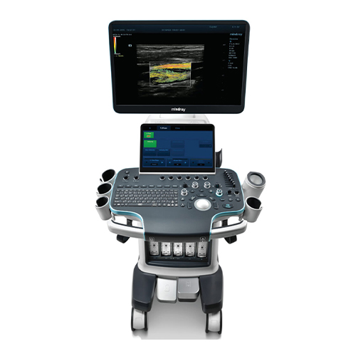 Mindray Resona R9 The Best and Cheapest Mindray Brand Resona R9 Color Trolley Doppler Premium Ultrasound System for Radiology