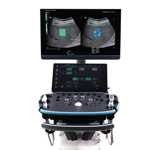 Mindray Resona I9 New Style Hot Selling Mindray Resona I9 Trolley Ultrasound Machine Color Doppler System Clinical Application Ultrasound Scanner