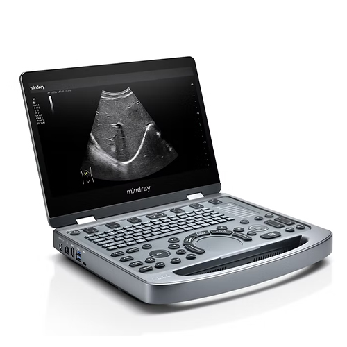 Mindray MX3 High End Ultrasonic Diagnostic System 4d Color Doppler Ultrasound Scanner