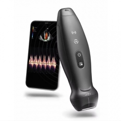 Mindray TE Air I3P Digital Ultrasound Machine Color Doppler 3d 4d Ultrasound Scanner