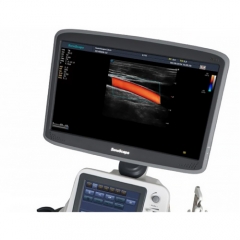 Sonoscape S15 Second Hand Refurbished Diagnostic Ultrasound Scanner 3d 4d Color Ultrasound Machine With Reasonable Price