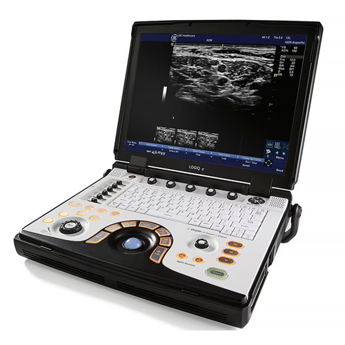 GE Logiq E second hand Refurbished Medical Instruments Trolley Color Doppler Ultrasound