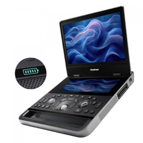 SonoScape X10 Laptop Color Doppler Ultrasound Machine Price Portable Color Doppler 3d 4d Ultrasound Scanner