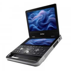 SonoScape X10 Laptop Color Doppler Ultrasound Machine Price Portable Color Doppler 3d 4d Ultrasound Scanner