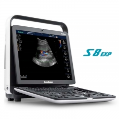 Sonoscape S8 EXP Portable Ultrasound Scanner Echocardiography Machine