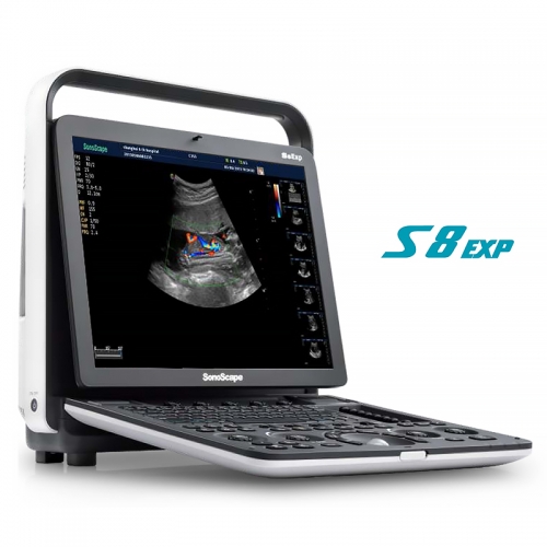 Sonoscape S8 EXP 5d Color Doppler Human Ultrasound & Cardiovascular Machine Gynecology Trolley Ultrasonic & Electronic Equipment