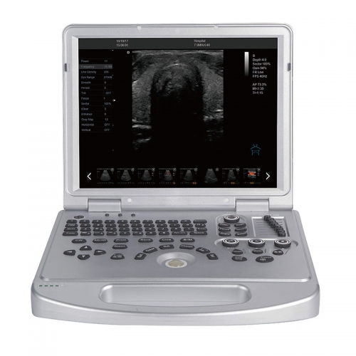 IN-L3VET Vet Best Price China Portable Ultrasound Scanner