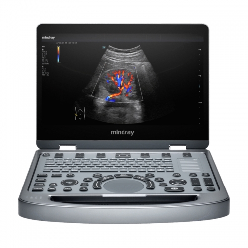 Mindray MX6 Ecografo Con Doppler 3d Ecografo 4d De Color Doppler Ultrasonido Precio Ultrasound Scanner Machine Cheap Price