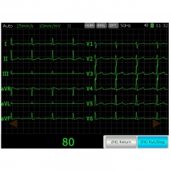 IN-03VET Ecg Machine Vet Electrocardiograma 3 Channel 7 Lead 12 Lead Machine For Veterinary