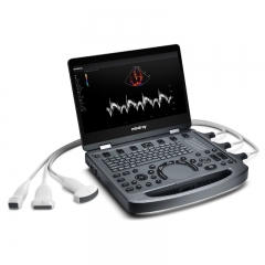 Mindray MX6 High Quality Electric Trolley Portable Doppler Ultrasound Machine For Hospitals Good Color Medical Equipment