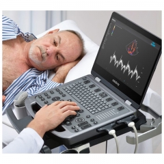 Mindray MX6 Ecografos Ultrasonido 4d Doppler Ultrasound Machine Digital Trolley Color Ultrasound Doppler