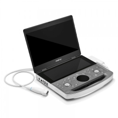 Mindray ME Series Clinical Diagnostic Ultrasound Machine for Human Use with High Resolution Imaging Performance