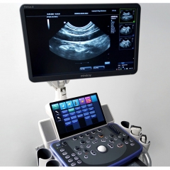 Mindray DC-80A Doppler Abdominal Ultrasound Machine Ultrasound Medical for Pregnancy Human