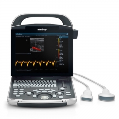 Mindray DP-30 Vet Veterinary Color Doppler and B-Mode Ultrasound with Dual Display Modes